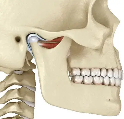Jaw Stabilization
